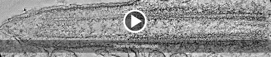 Cilium in a Spermatocyte